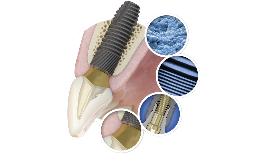 Astra Tech Dental Implant DrillKit 新品未使用 Astra Tech Dental Implant DrillKit 新品未使用 ✓✓Astra Tech