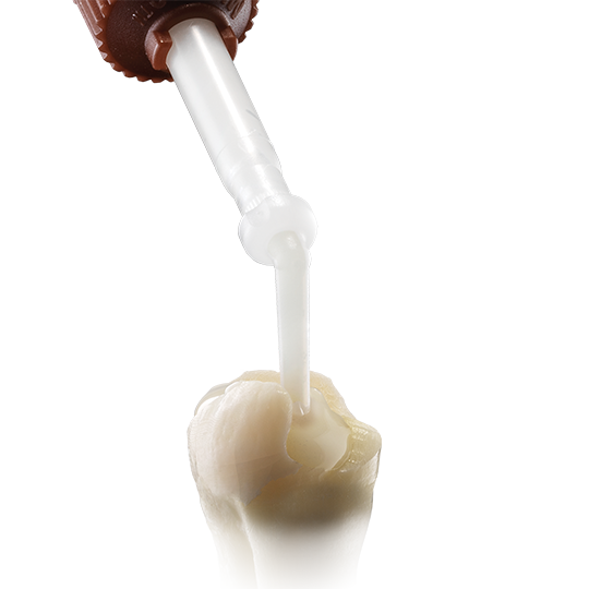 FluoroCore 2+ Core Build Up I Dentsply Sirona USA
