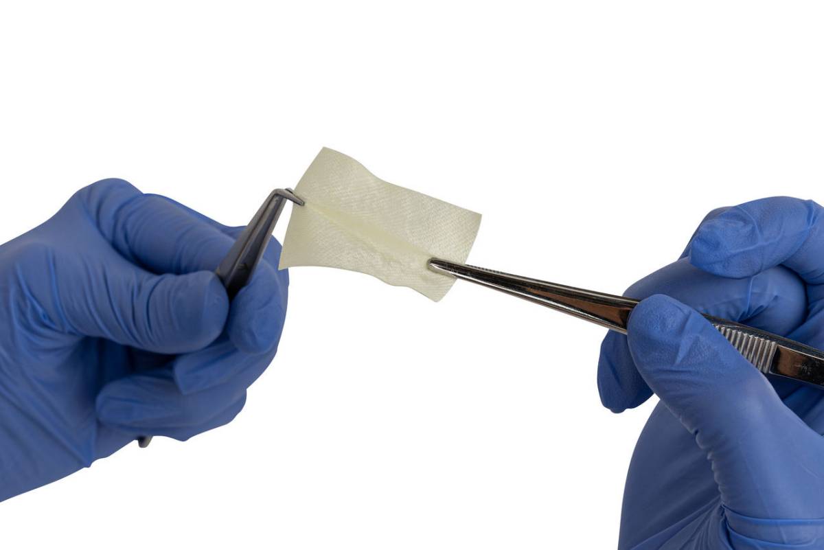 jaw bone with lingual flap