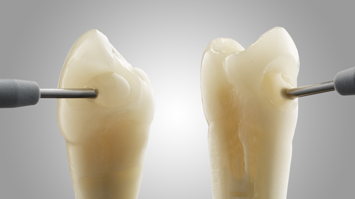 SDR flow+ Bulk Fill Flowable Composite Dentsply Sirona