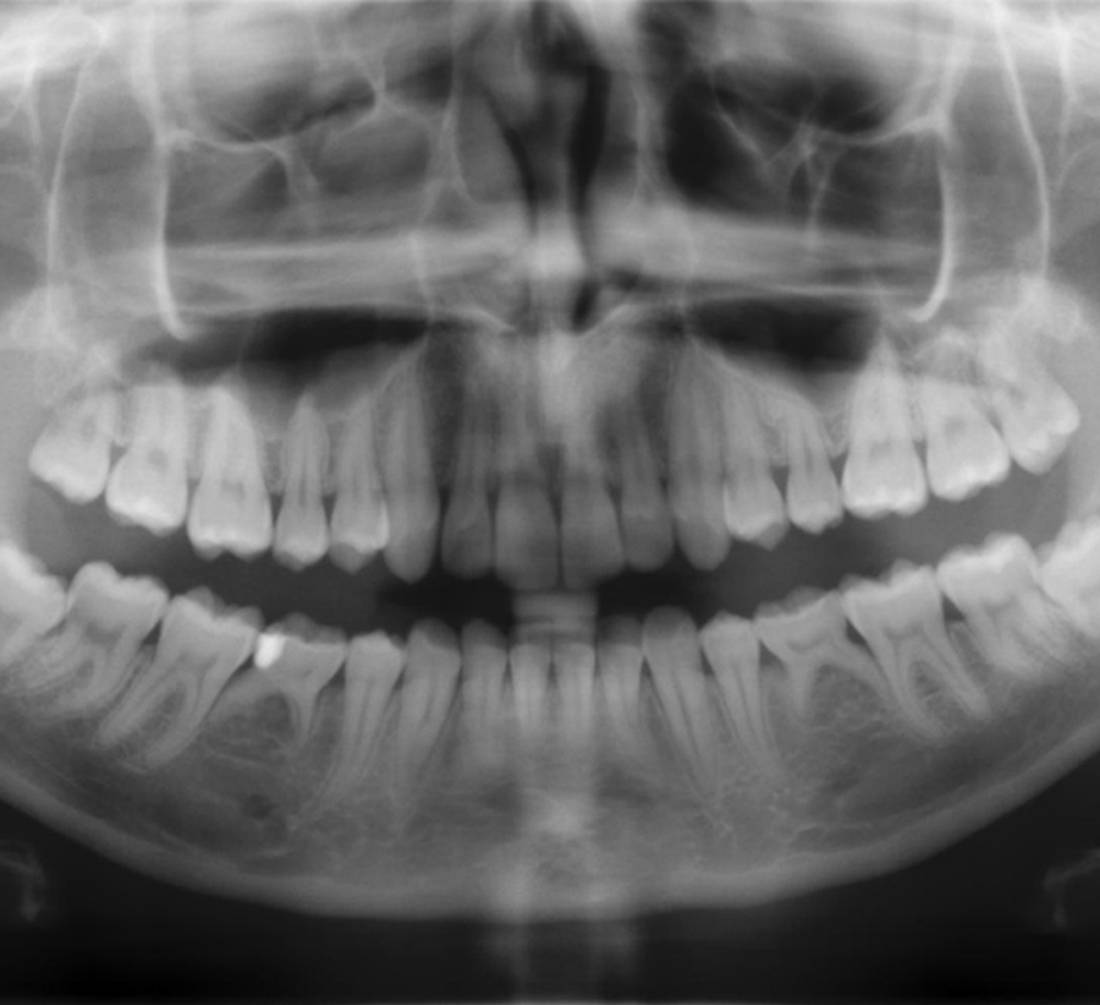 Xray dentsply sirona top