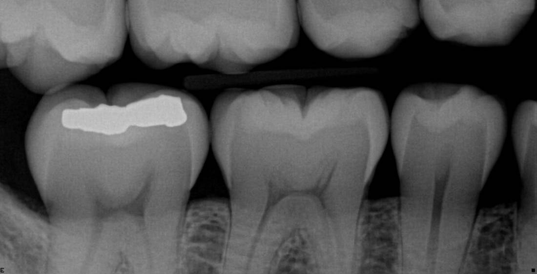 Xray dentsply sirona on sale