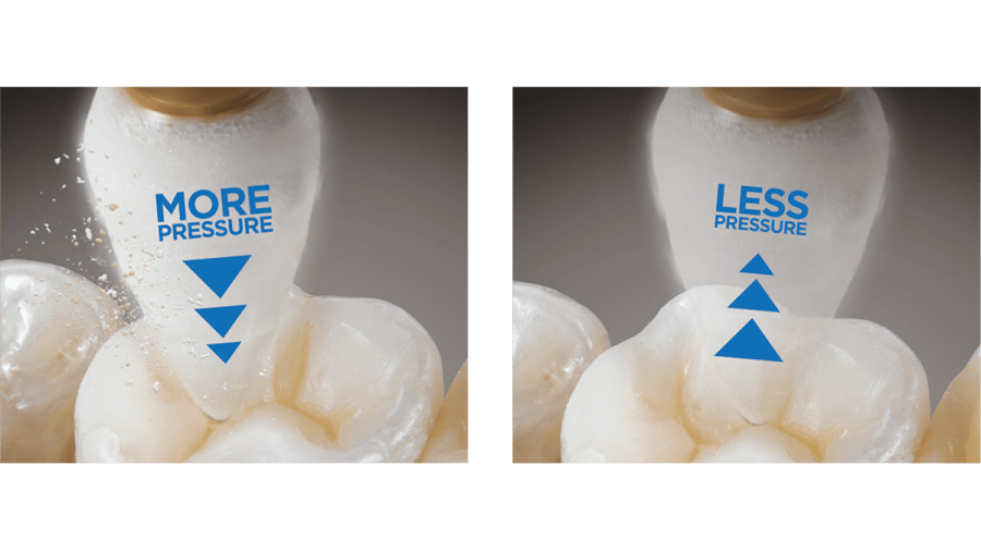Class II Restorative Procedures Guide | Dentsply Sirona USA