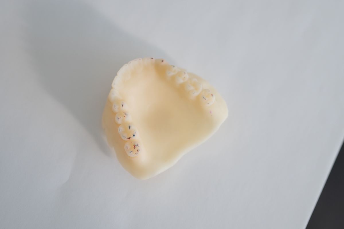 Marked Occlusal | Lucitone Digital Print Denture System
