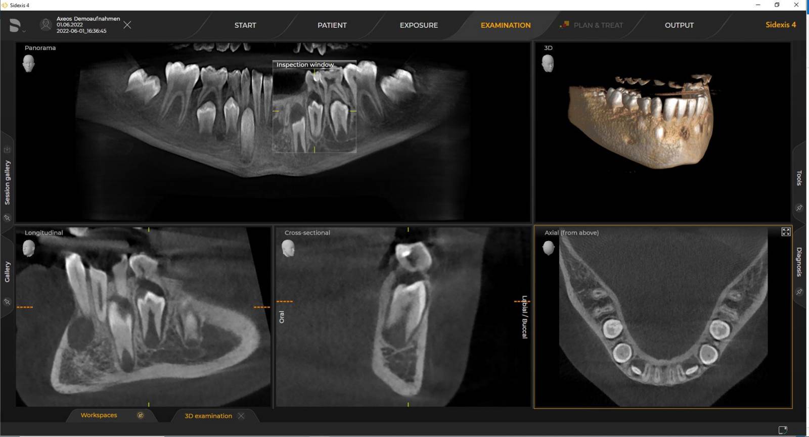 3D X-ray Ø 8 cm x 5 cm Standard Definition