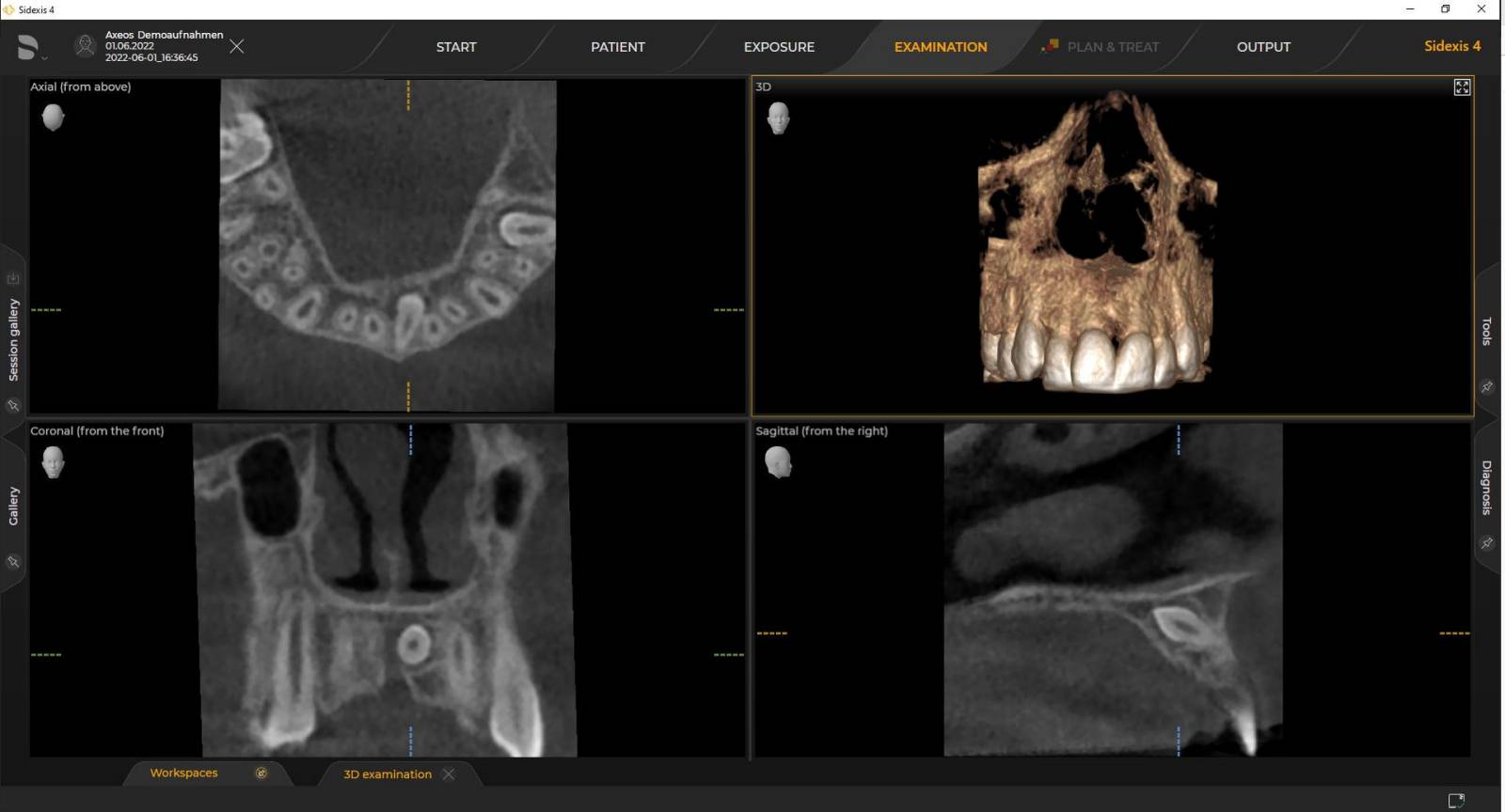 3D X-ray Ø 5 cm x 5.5 cm Low Dose