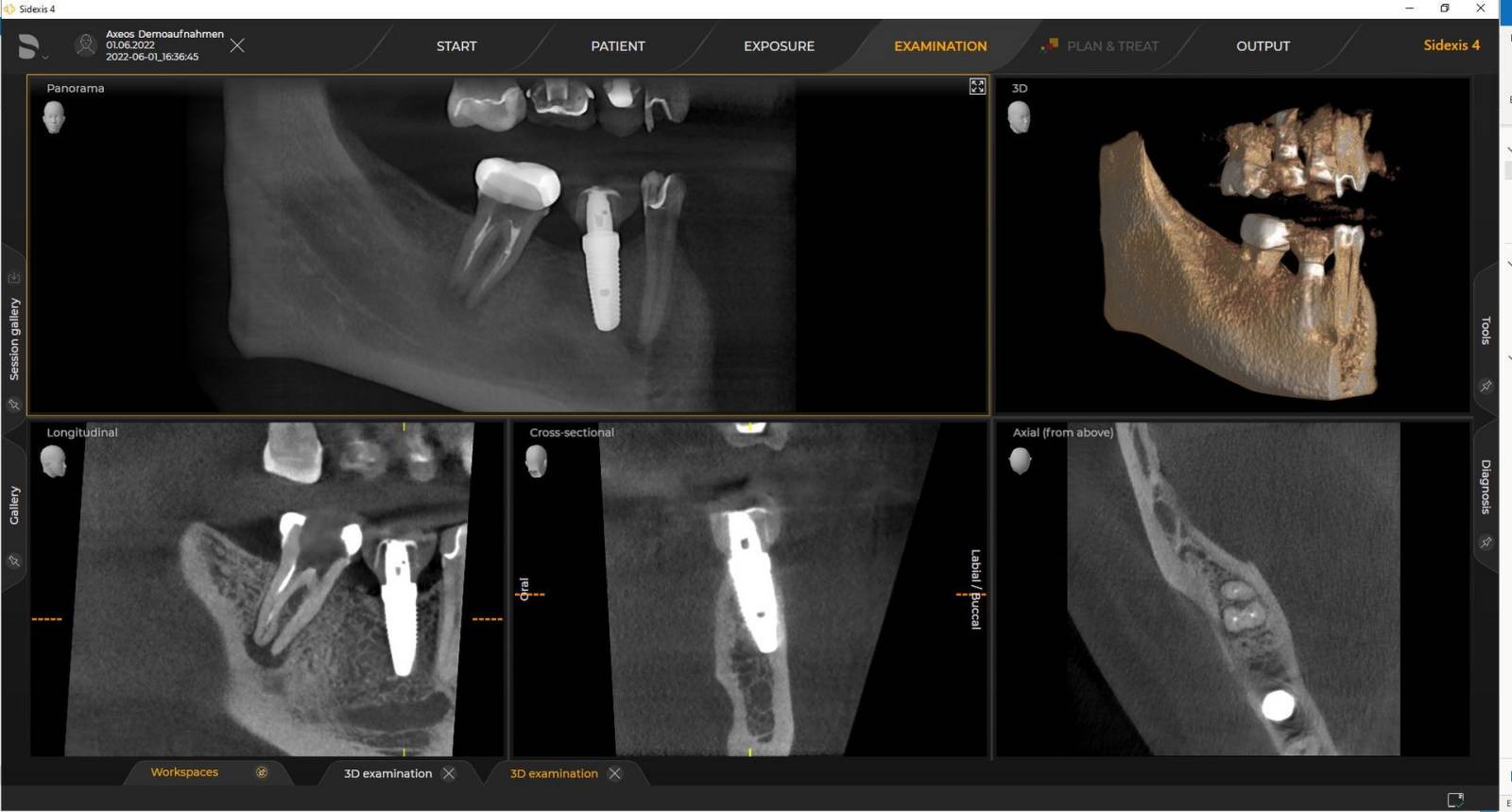3D X-ray Ø 5 cm x 5.5 cm HD
