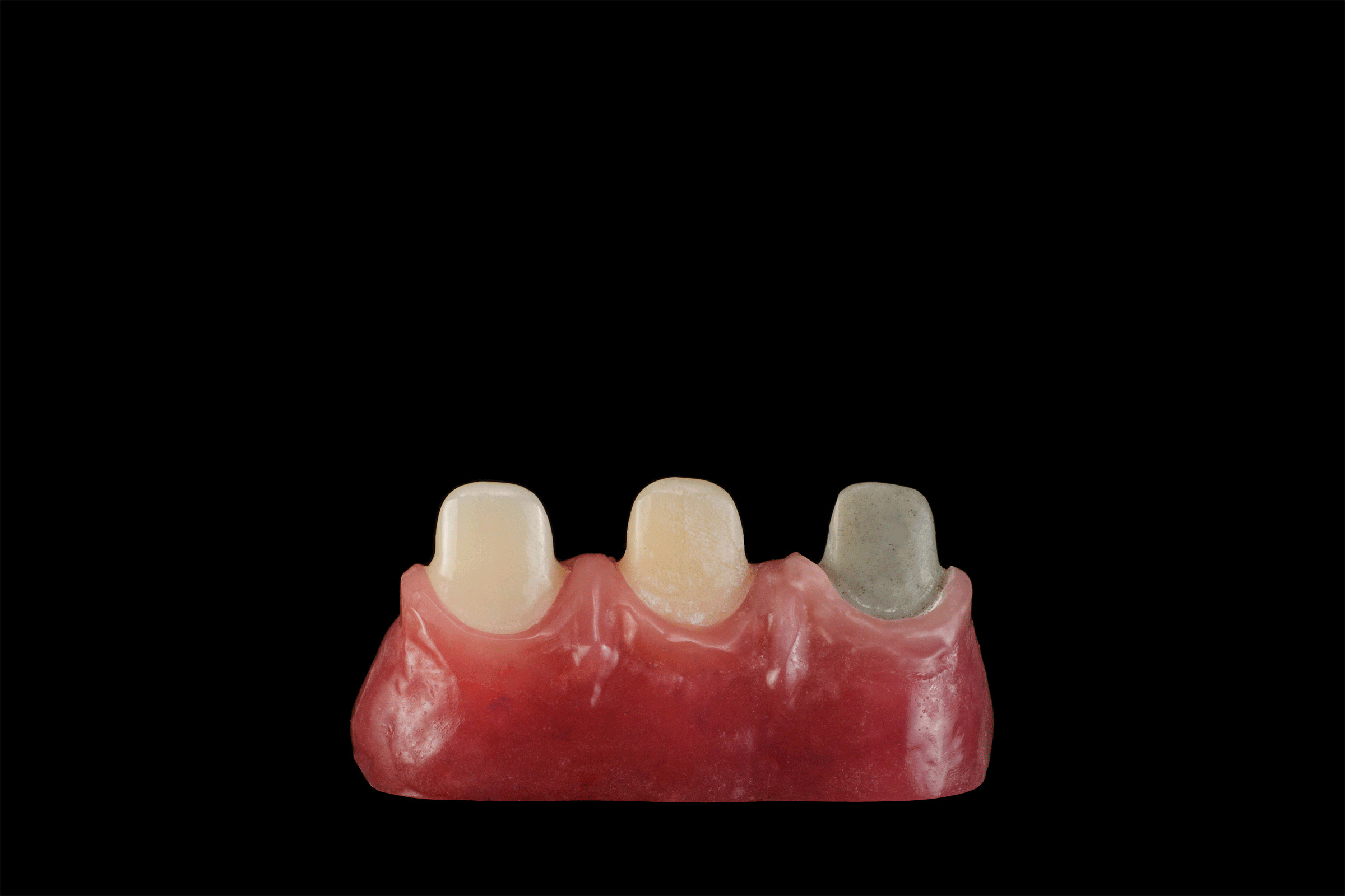 animated graphic of teeth