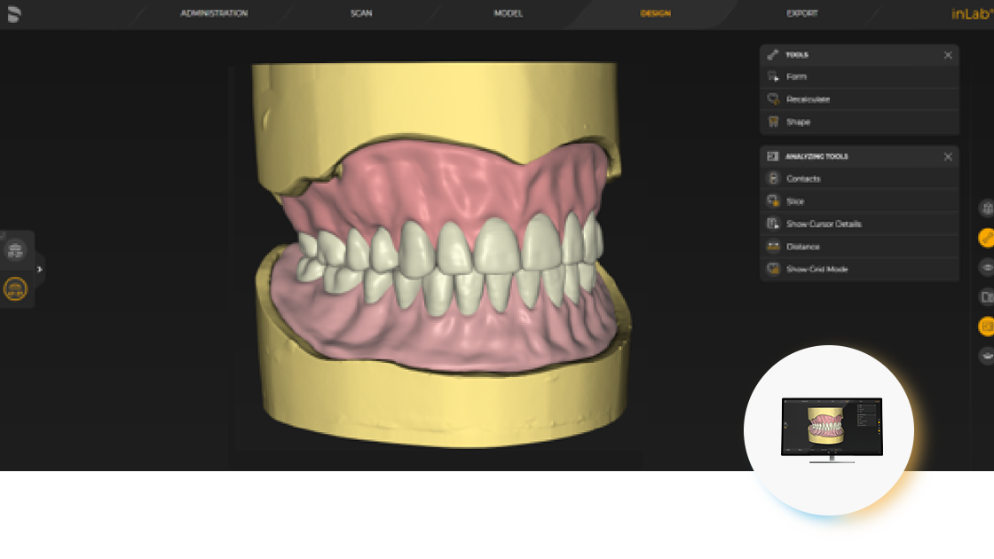 inLab CAD Software screens