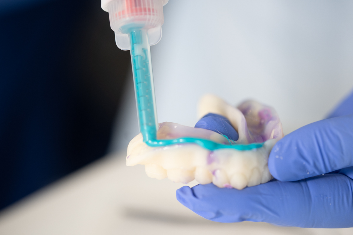 Re-impressing Try-In | Lucitone Digital Print Denture System