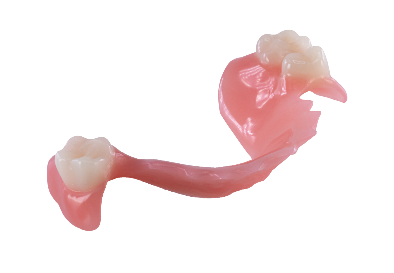 Partial manufactured with the Lucitone Digital Print™ Denture System