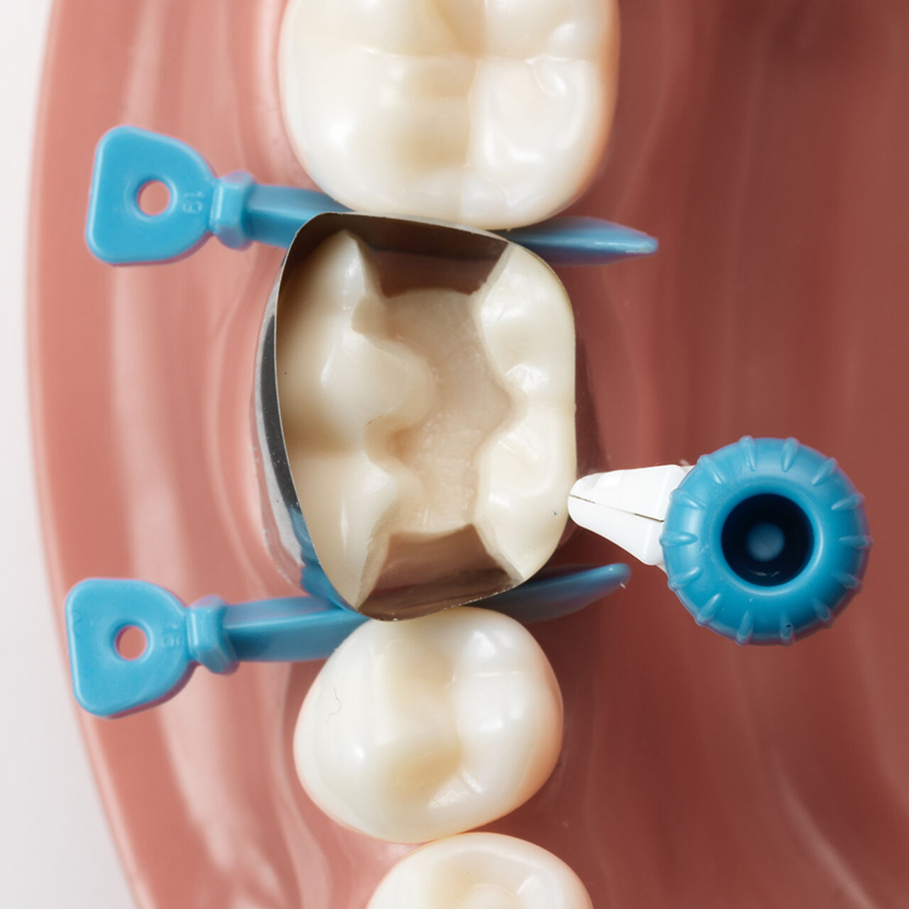 Demo on model showing placement of Palodent 360 in various positions