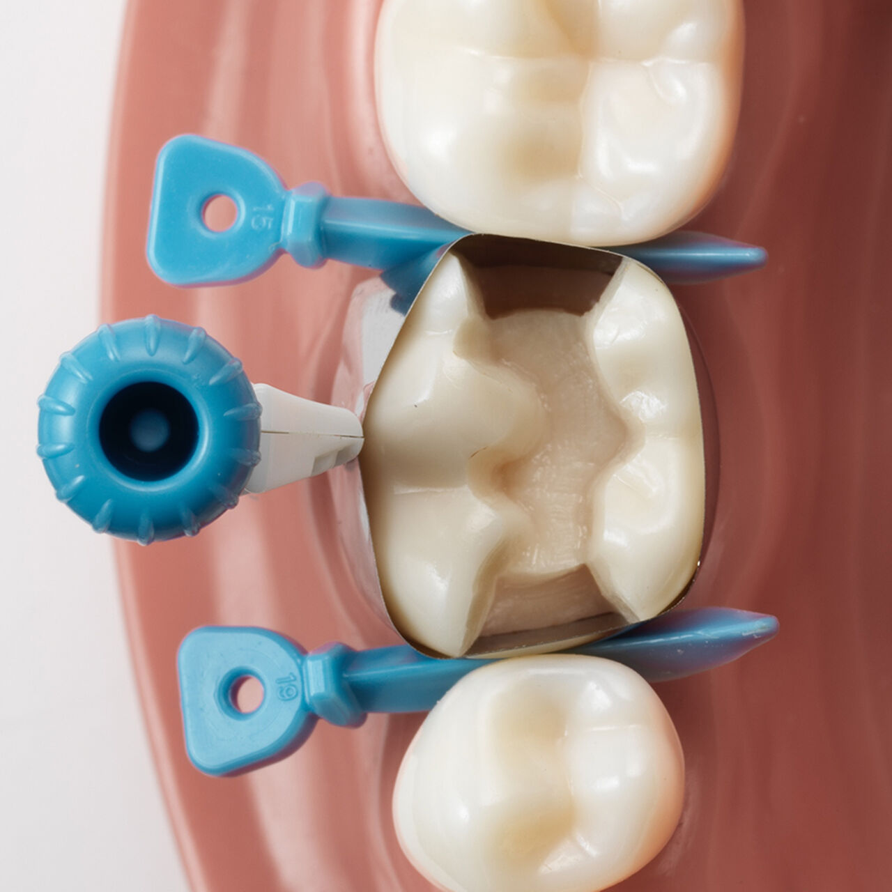 Demo on model showing placement of Palodent 360 in various positions