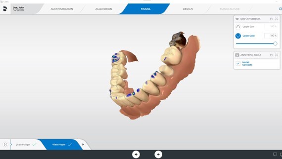 Sistemas CEREC CAD/CAM | Dentsply Sirona España