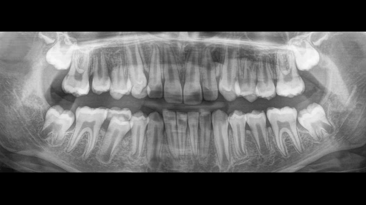 Imagen radiológica dental de un paciente infantil