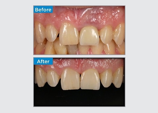 IMG-ANZ-Dr Alan Yap-Clinical Case Spotlight-thumbnail image.jpg