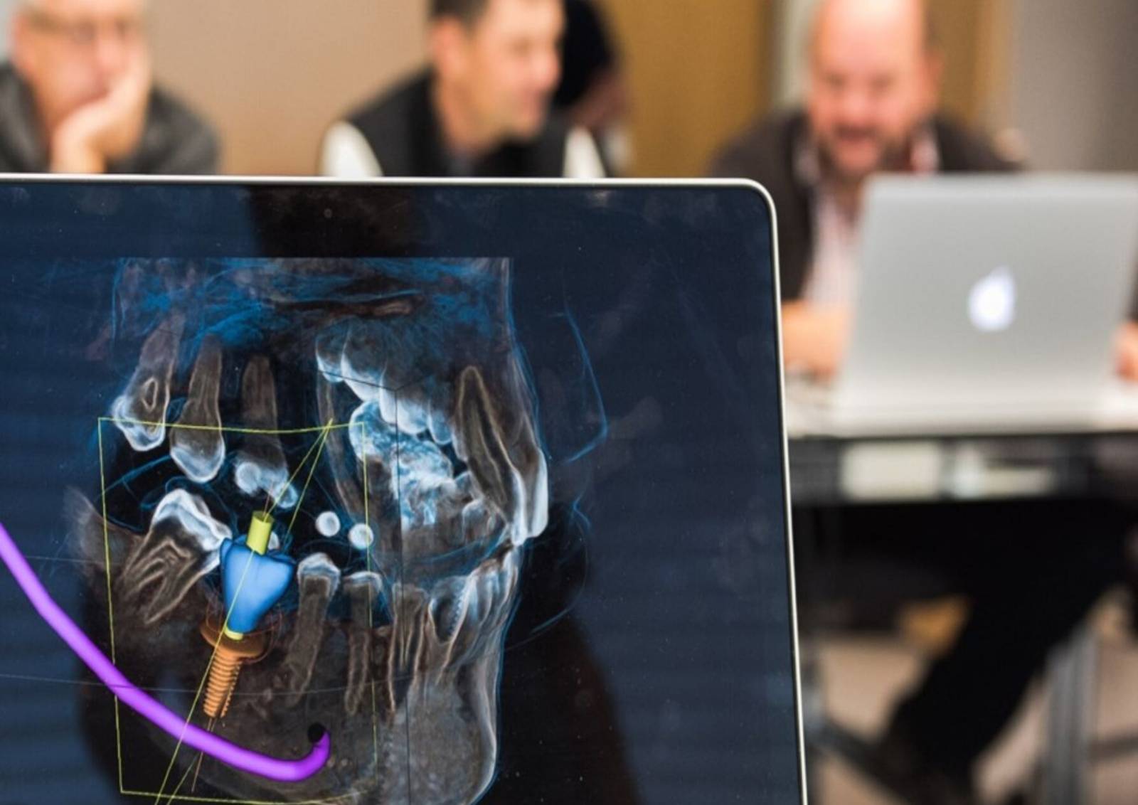 CE CADCAM scan in lecture