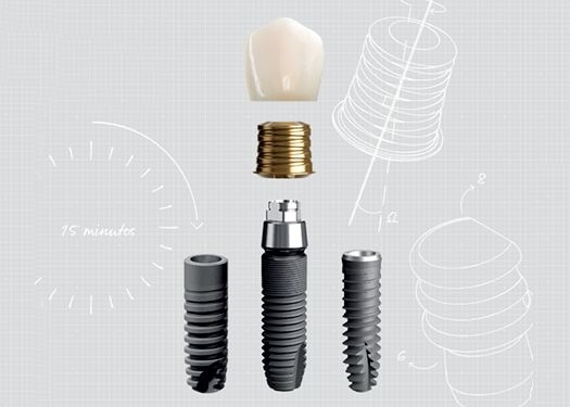 Dentsply Sirona Implants - Acuris