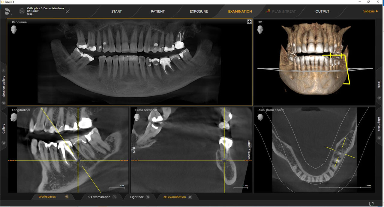Radiographie 3D