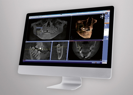 Galileos Implant Dental Software