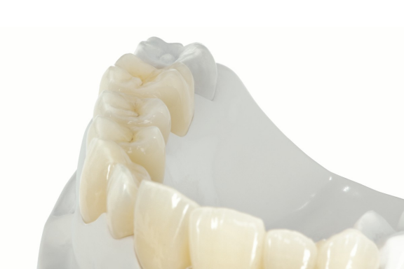 Dental Lab All-Ceramic Framework
