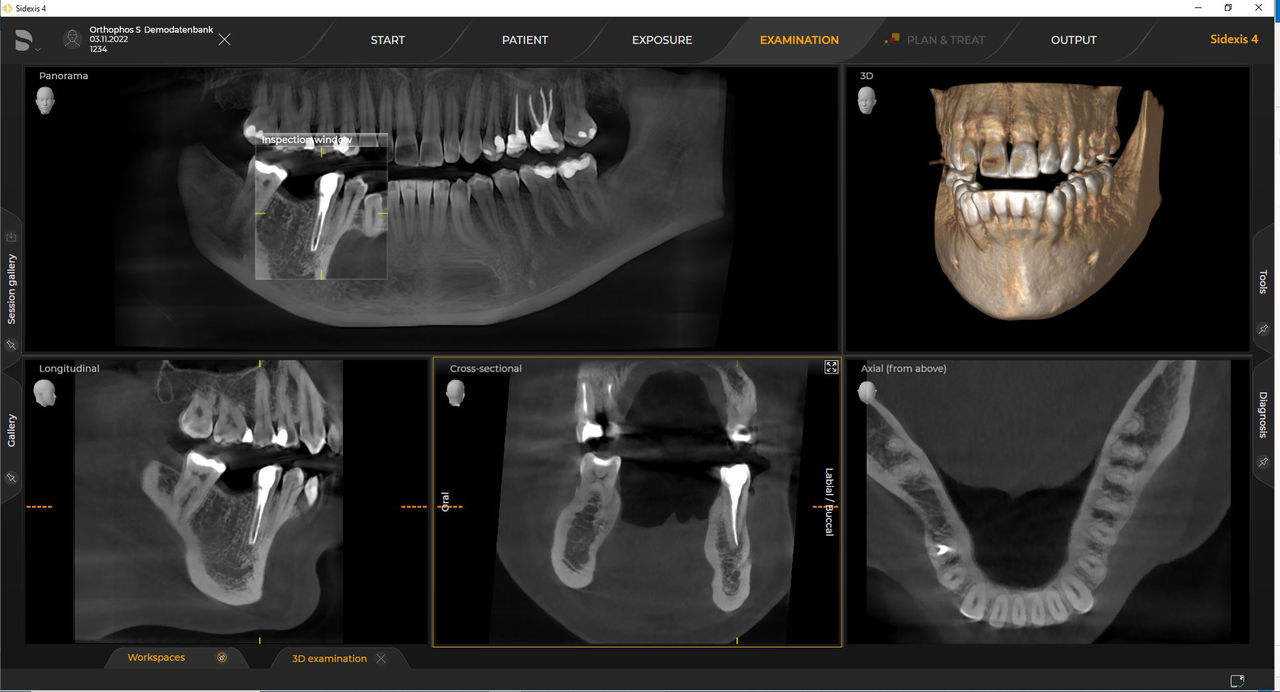 Radiographie 3D
