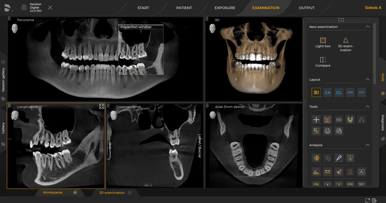 Radiographie dentaire d’un cas d’implant