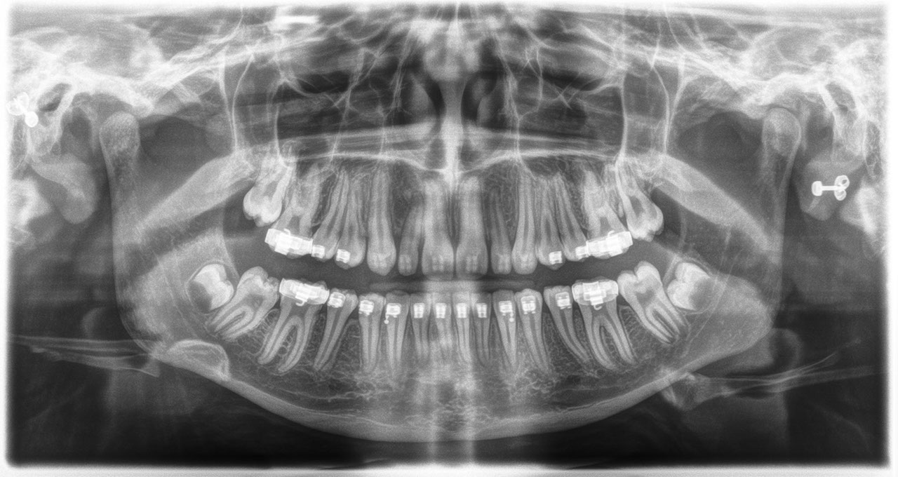 Radiografia extraorale 