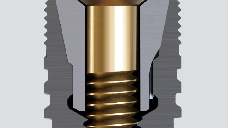 アストラテックインプラントシステムEV | デンツプライシロナ 日本