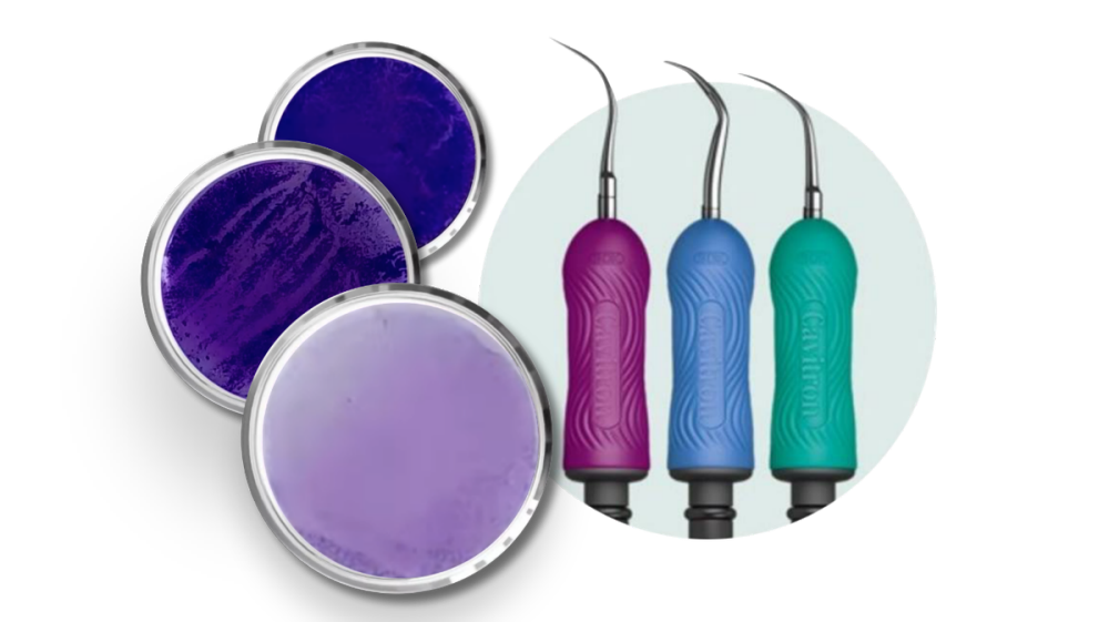 キャビトロン300 超音波スケーリングシステム | デンツプライシロナ 日本