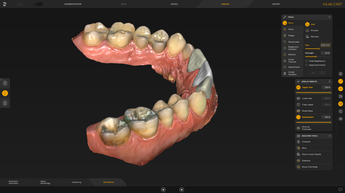 歯科医師のためのCAD/CAMソリューション：詳しくはこちら
