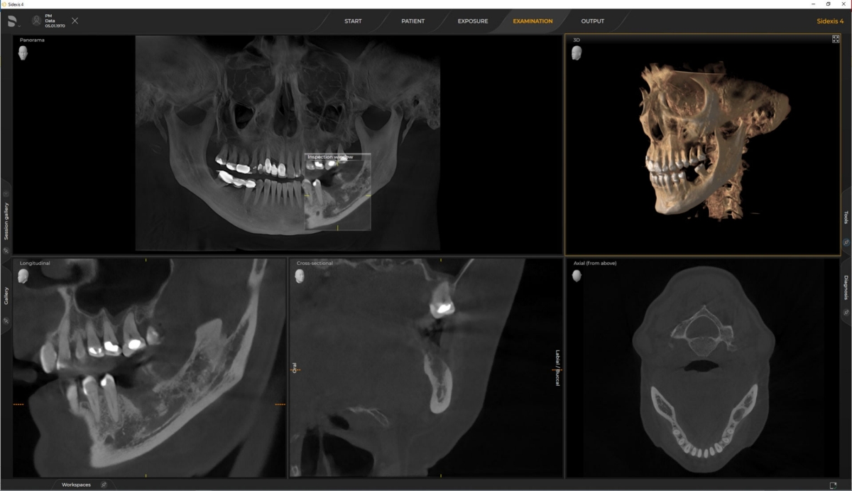 X-ray of digital dental unit Axeos 
