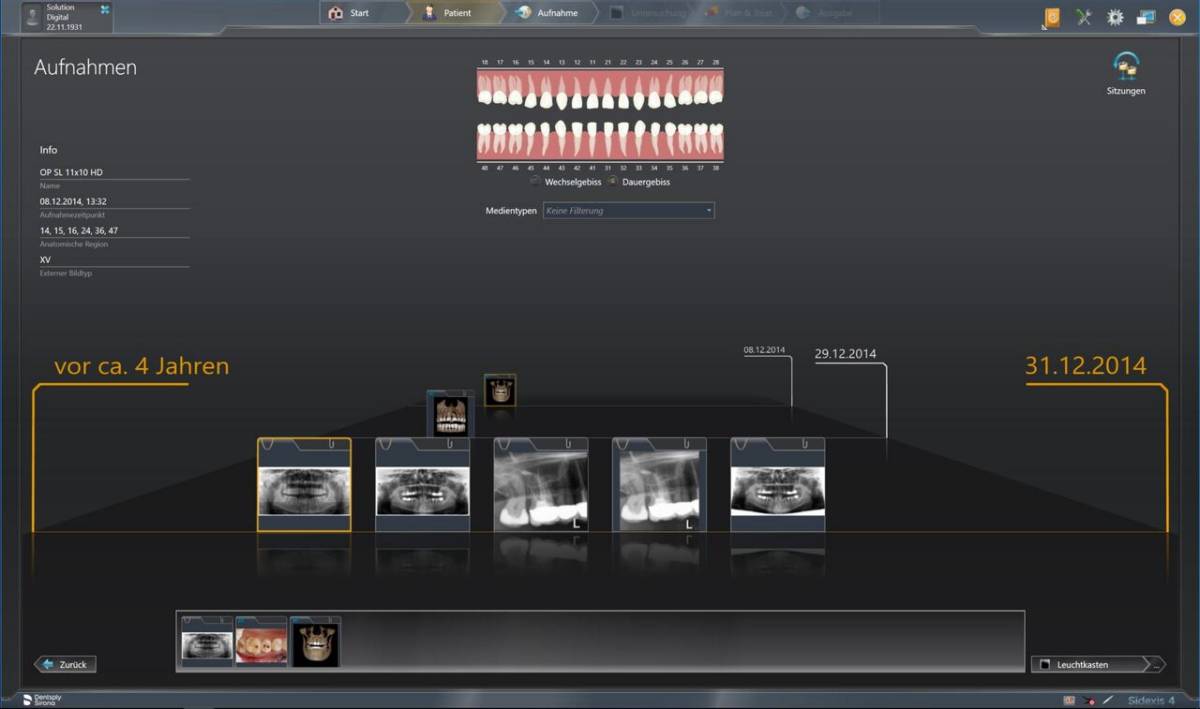 Sidexis Timeline