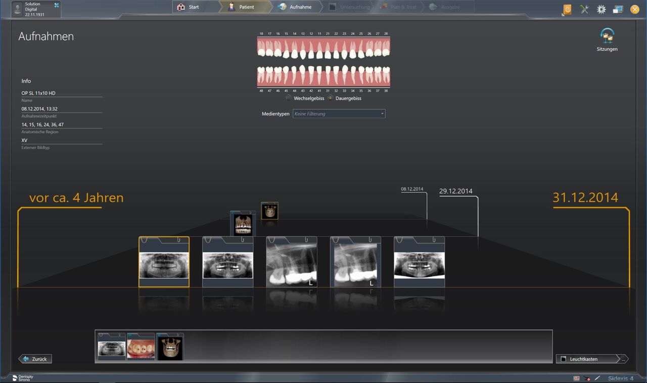 Sidexis Timeline