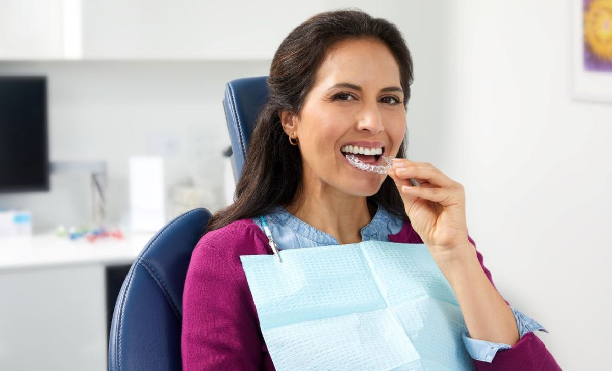 SureSmile Aligner