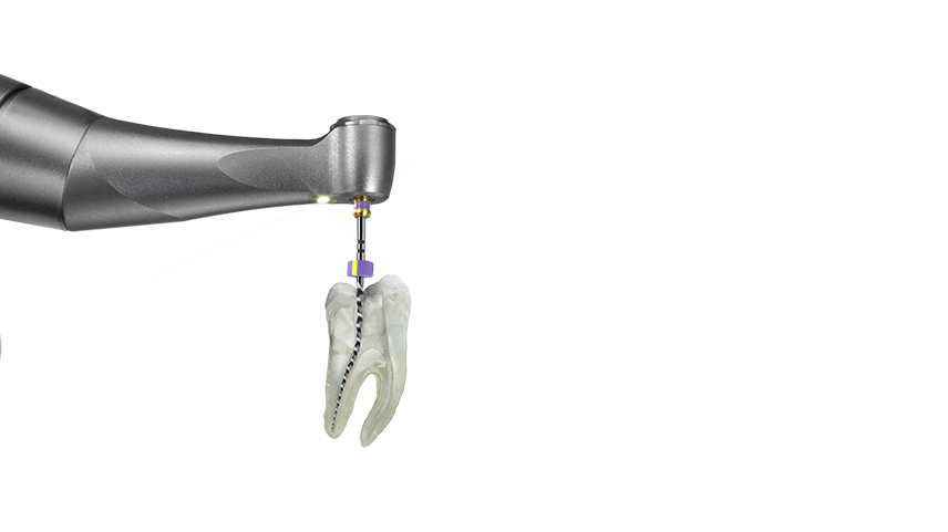 X-smart pro plus