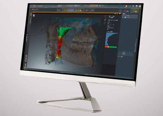 Monitor showing the Dental Software SICAT Air