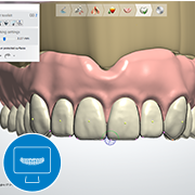 scanning & designing 3d printed dentures