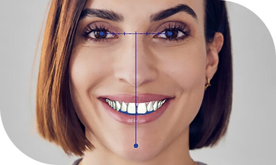 SureSmile Clear Aligners - Smiles by Design