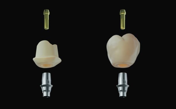 patiëntspecifieke tandheelkundige abutments, zirkonia abutmentoplossingen, CEREC abutment