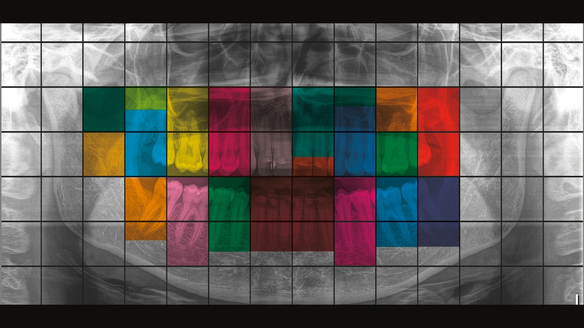 x-ray image with coloured areas