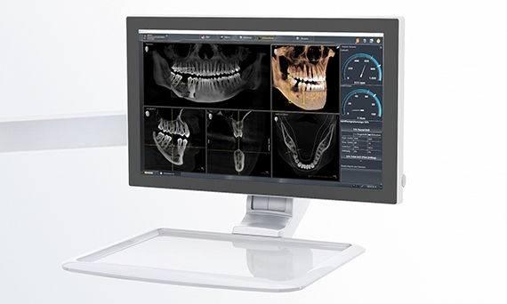 Display of dental unit plugin on the Sivision monitor of a treatment center