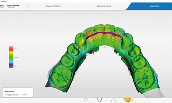 Analysis of an intraoral scan