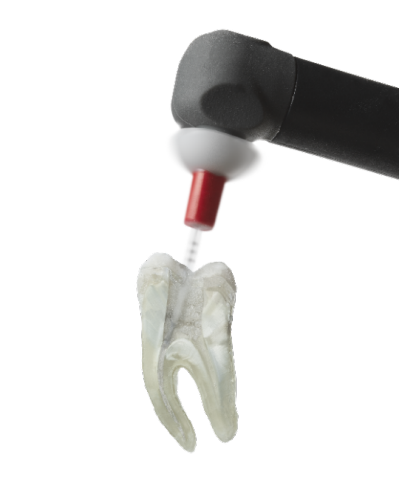 Image of tooth cut in half to see the activating of the irrigant inside
