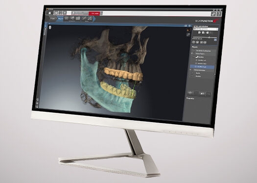 Monitor showing the Dental Software SICAT Function