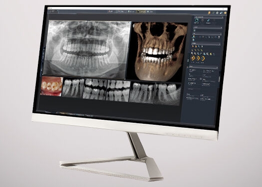 Monitor showing the Imaging Software Sidexis 4