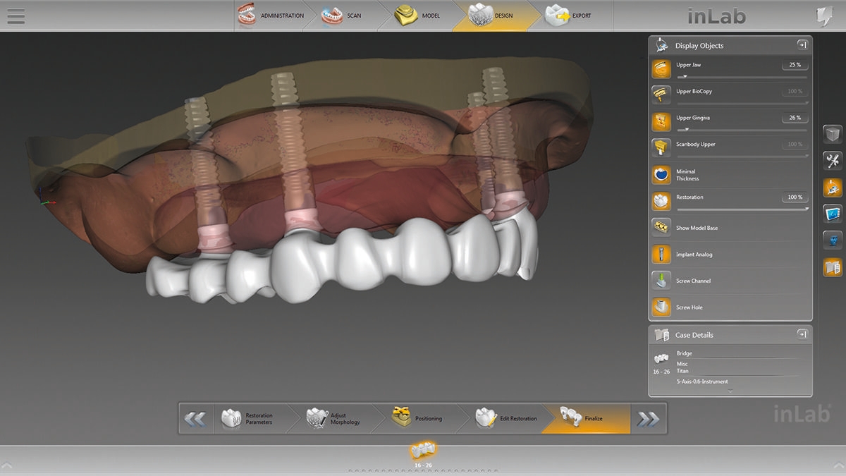 inLab CAD Software, Implantology module, screw retained bridge