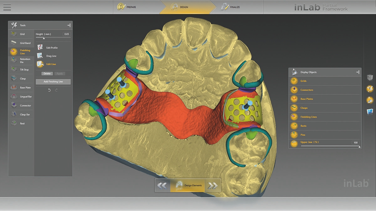 inLab CAD Software, removable partial dentures