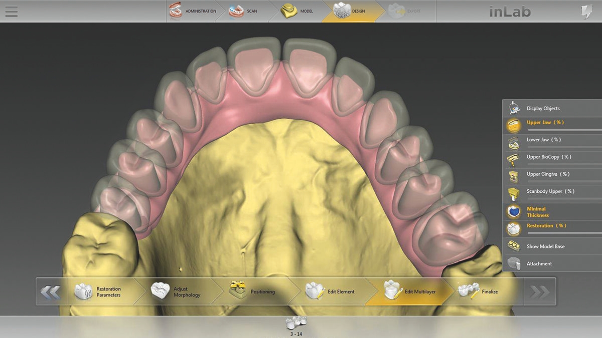 inLab CAD Software, Multi-layer-gingiva