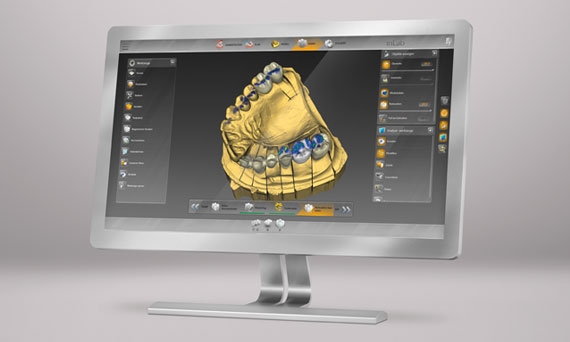 Monitor with inLab CAD Software
